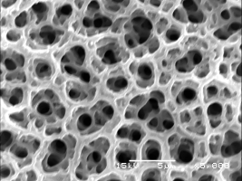 Porosity and Surface Area Characterization